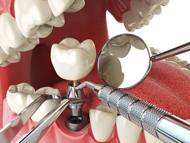 Emergency Dentist for Kids in SC